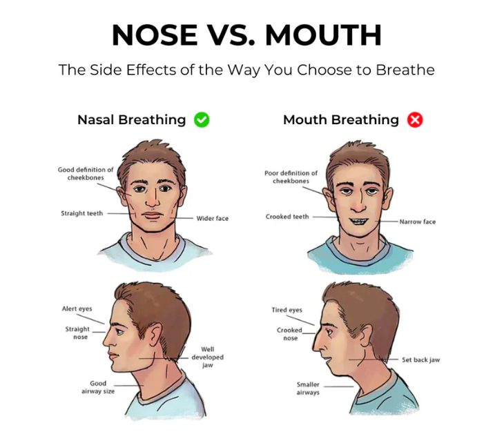 Mog Tape™ Mouth Tape